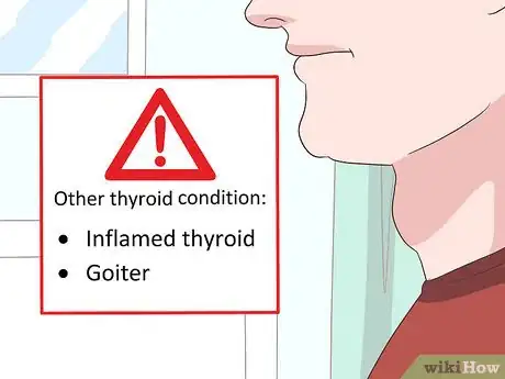 Image intitulée Diagnose Thyroid Cancer Step 15