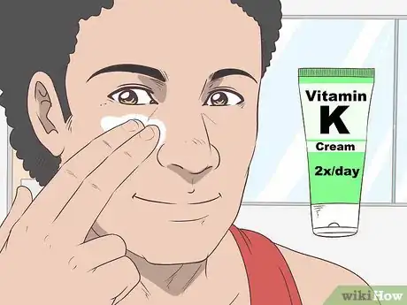 Image intitulée Treat Bruises on Your Face Step 10