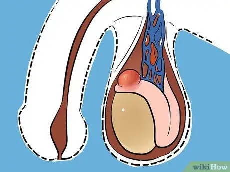 Image intitulée Treat a Cyst Step 7