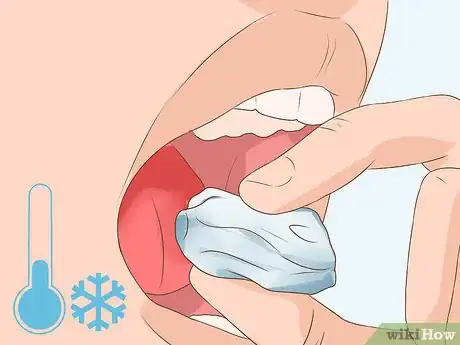 Image intitulée Heal a Bitten Tongue Step 5