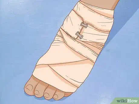 Image intitulée Apply Different Types of Bandages Step 10