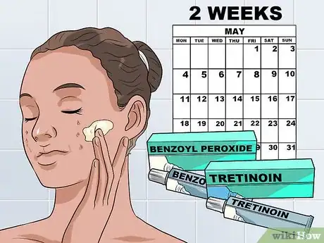 Image intitulée Use Tretinoin and Benzoyl Peroxide Concurrently Step 1