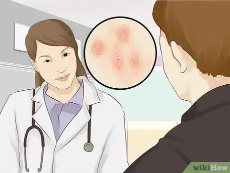 Image intitulée Treat a Yeast Infection on Your Skin Step 6.jpeg