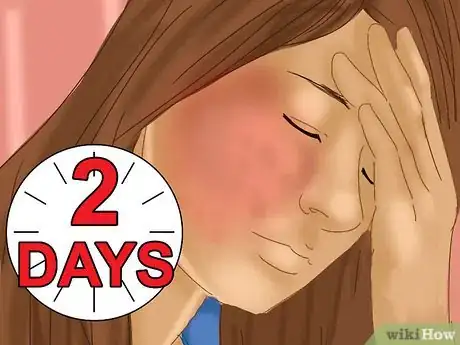 Image intitulée Get Rid of a Rash on Your Face Step 10