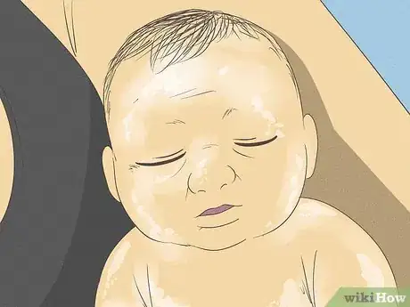 Image intitulée Know What to Expect on a Newborn's Skin Step 6