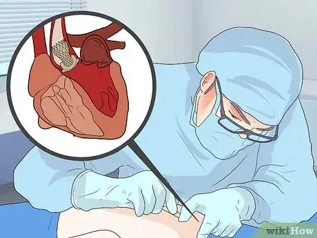 Image intitulée Recognize a Leaking Heart Valve Step 11