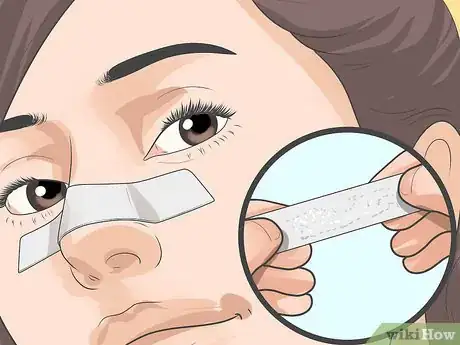 Image intitulée Get Rid of Acne on Your Nose Step 4