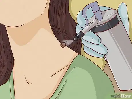 Image intitulée Remove a Skin Tag from Your Neck Step 3