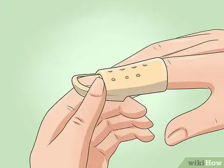 Image intitulée Splint Trigger Finger Step 14