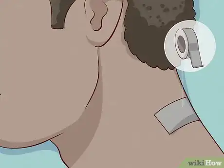 Image intitulée Remove a Skin Tag from Your Neck Step 21
