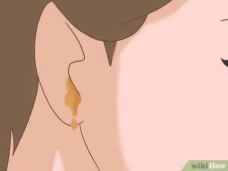 Image intitulée Soothe an Ear Ache Step 10