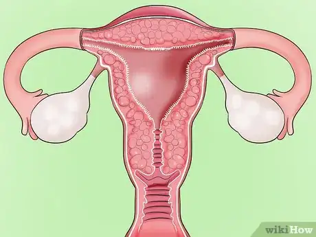 Image intitulée Cope with Vaginismus Step 11