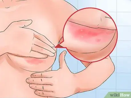 Image intitulée Prevent Mastitis Step 12