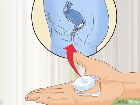 Image intitulée Buy the Morning After Pill Step 19