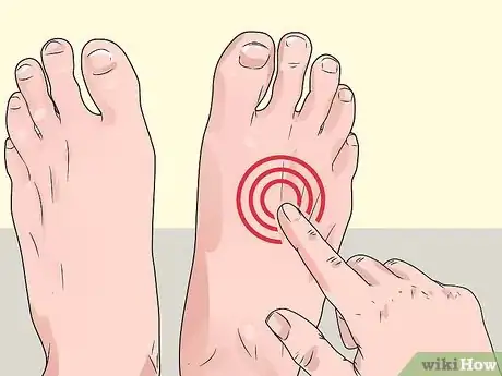 Image intitulée Check Feet for Complications of Diabetes Step 3