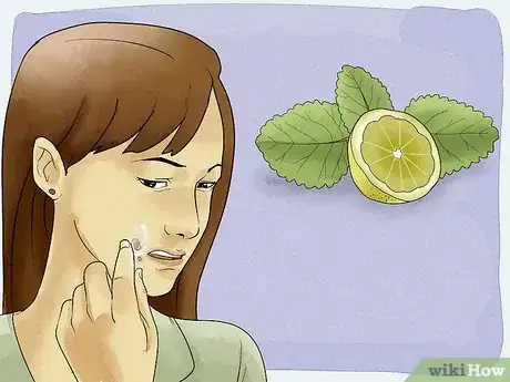 Image intitulée Get Rid of a Cold Sore with Home Remedies Step 5