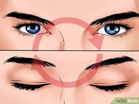 Image intitulée Heal a Scratched Cornea Step 1