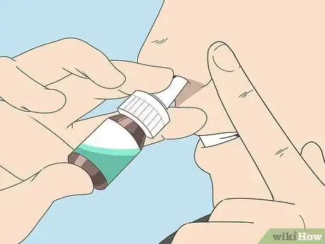 Image intitulée Get Rid of a Sinus Infection Without Antibiotics Step 2