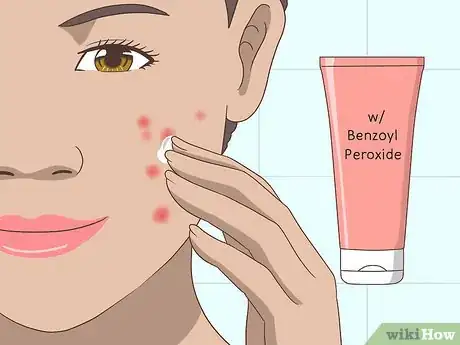 Image intitulée Prevent Oily Skin Step 6