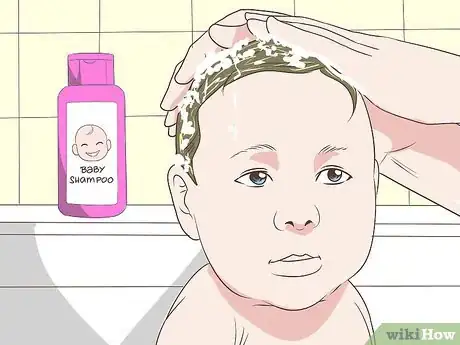 Image intitulée Heal Scalp Eczema Step 20