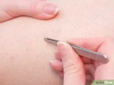 Image intitulée Prevent Ingrown Hairs on Your Legs Step 8