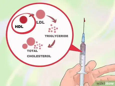 Image intitulée Test for Insulin Resistance Step 6