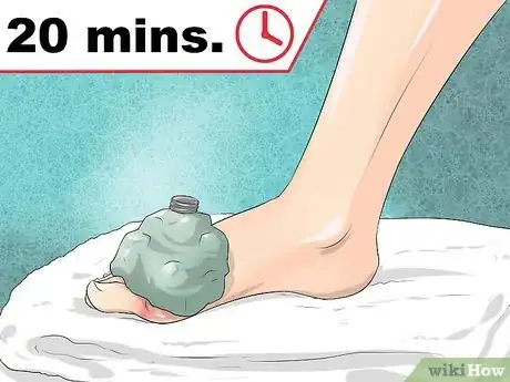 Image intitulée Get Gout Relief at Home Step 2