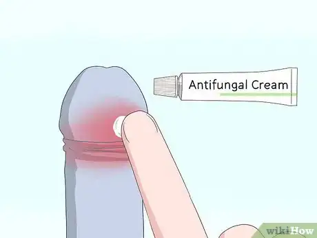 Image intitulée Pull Your Foreskin Back Without Pain Step 12