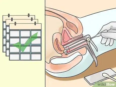 Image intitulée Get Rid of a Cyst Step 11