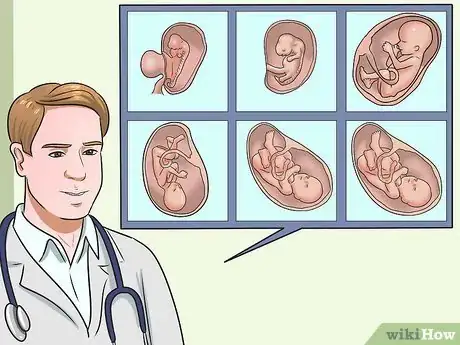 Image intitulée Hear the Fetal Heartbeat Step 10