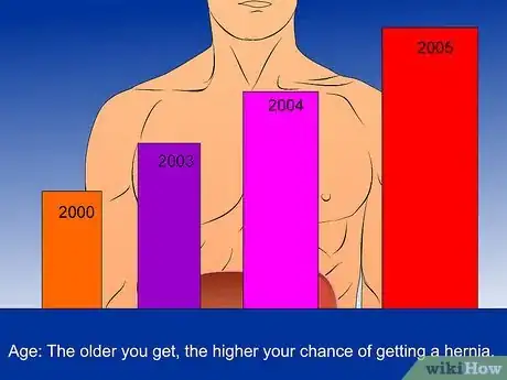 Image intitulée Check for a Hernia Step 6Bullet2