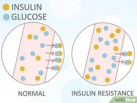 Image intitulée Manage Gestational Diabetes Without Medication Step 12