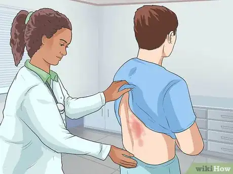 Image intitulée Diagnose Psoriasis Step 8