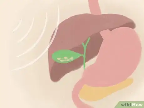 Image intitulée Relieve Biliary Colic Pain Step 11