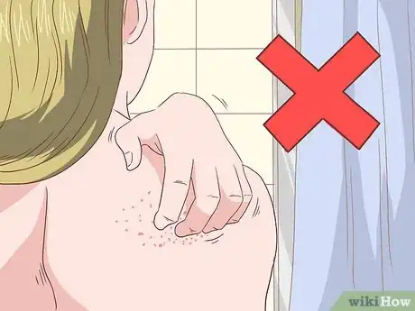 Image intitulée Get Rid of Itchy Skin with Home Remedies Step 12