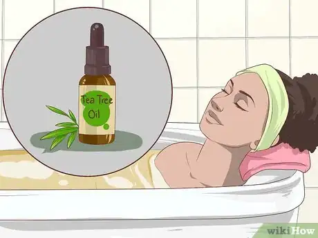 Image intitulée Get Rid of Back Acne Fast Step 5