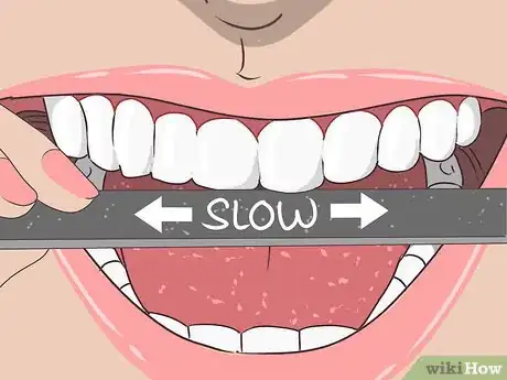 Image intitulée File Down a Sharp Tooth Step 3