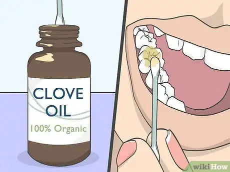 Image intitulée Use Clove Oil for Tooth Pain Step 2