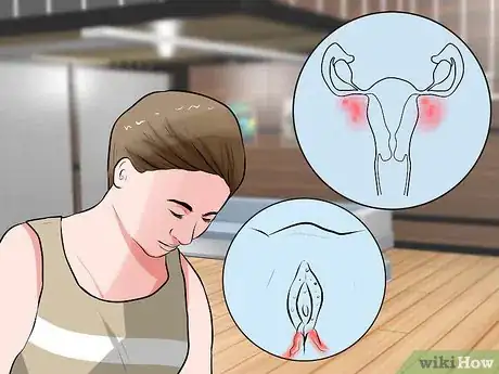 Image intitulée Recognize Vulva Cancer Symptoms Step 4