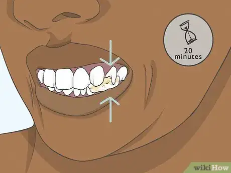 Image intitulée Use Clove Oil for Tooth Pain Step 9