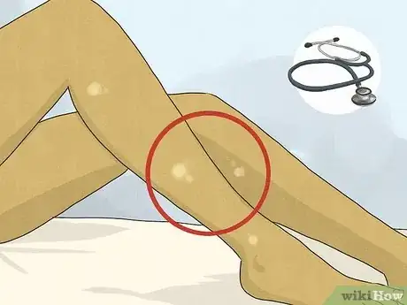 Image intitulée Avoid Itching After Waxing Step 13