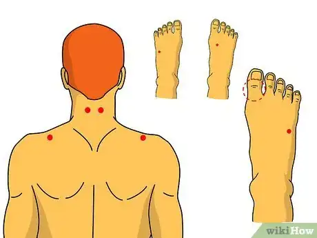 Image intitulée Do Acupressure Step 2