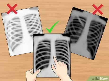 Image intitulée Read a Chest X Ray Step 5