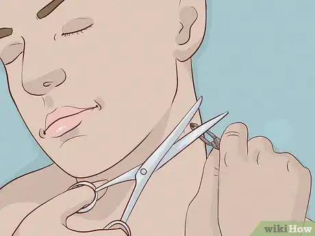 Image intitulée Remove a Skin Tag from Your Neck Step 8