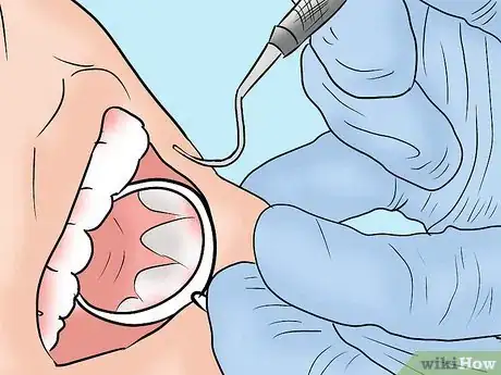 Image intitulée Get Rid of Tooth Pain Step 18