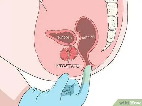 Image intitulée Locate Your Prostate Step 7