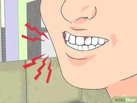 Image intitulée Recognize Tooth Enamel Loss Step 5