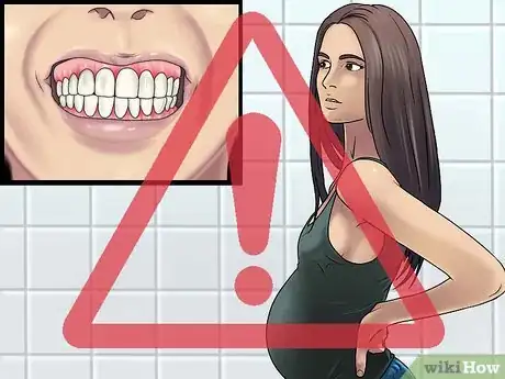 Image intitulée Detect Gum Disease Step 18