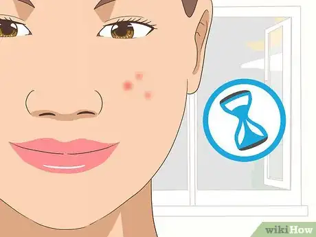 Image intitulée Use Tea Tree Oil for Acne Step 6