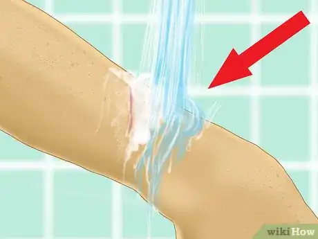 Image intitulée Heal a Cut Due to Dry Skin Step 6